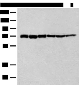 TCF25 Antibody - Western blot analysis of 293T cell Human fetal brain tissue Jurkat cell Hela cell Mouse heart tissue lysates  using TCF25 Polyclonal Antibody at dilution of 1:250