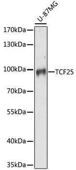 TCF25 Antibody - Western blot analysis of extracts of U-87MG cells using TCF25 Polyclonal Antibody at dilution of 1:1000.