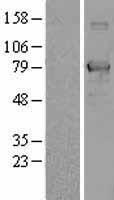 TCF25 Protein - Western validation with an anti-DDK antibody * L: Control HEK293 lysate R: Over-expression lysate