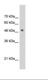 TCF3 / E2A Antibody - Jurkat Cell Lysate.  This image was taken for the unconjugated form of this product. Other forms have not been tested.