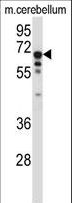 TCF3 / E2A Antibody - TCF3 Antibody western blot of mouse cerebellum tissue lysates (35 ug/lane). The TCF3 antibody detected the TCF3 protein (arrow).