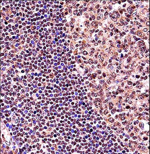 TCF3 / E2A Antibody - TCF3 Antibody immunohistochemistry of formalin-fixed and paraffin-embedded human tonsil tissue followed by peroxidase-conjugated secondary antibody and DAB staining.