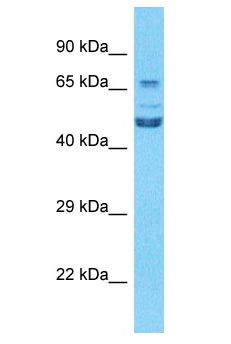 TCF3 / E2A Antibody - TCF3 / E2A antibody Western Blot of 786-0. Antibody dilution: 1 ug/ml.  This image was taken for the unconjugated form of this product. Other forms have not been tested.