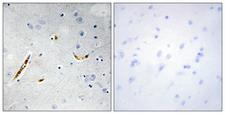 TCF3 / E2A Antibody - Immunohistochemistry analysis of paraffin-embedded human brain tissue, using TCF3 Antibody. The picture on the right is blocked with the synthesized peptide.