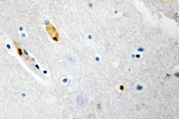 TCF3 / E2A Antibody - IHC of TCF-3 (N601) pAb in paraffin-embedded human brain tissue.
