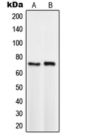 TCF3 / E2A Antibody - Western blot analysis of TCF3 expression in HeLa (A); BYDP (B) whole cell lysates.