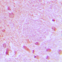 TCF3 / E2A Antibody - Immunohistochemical analysis of TCF3 staining in human brain formalin fixed paraffin embedded tissue section. The section was pre-treated using heat mediated antigen retrieval with sodium citrate buffer (pH 6.0). The section was then incubated with the antibody at room temperature and detected using an HRP conjugated compact polymer system. DAB was used as the chromogen. The section was then counterstained with hematoxylin and mounted with DPX.