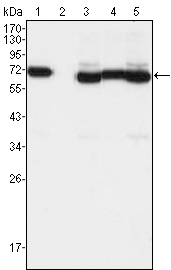 TCF3 / E2A Antibody - Western blot using TCF3 mouse monoclonal antibody against A549 (1), A431 (2), HeLa (3), PANC-1 (4) and PC-3 (5) cell lysate.