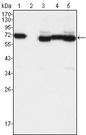 TCF3 / E2A Antibody - Western blot using TCF3 mouse monoclonal antibody against A549 (1), A431 (2), HeLa (3), PANC-1 (4) and PC-3 (5) cell lysate.
