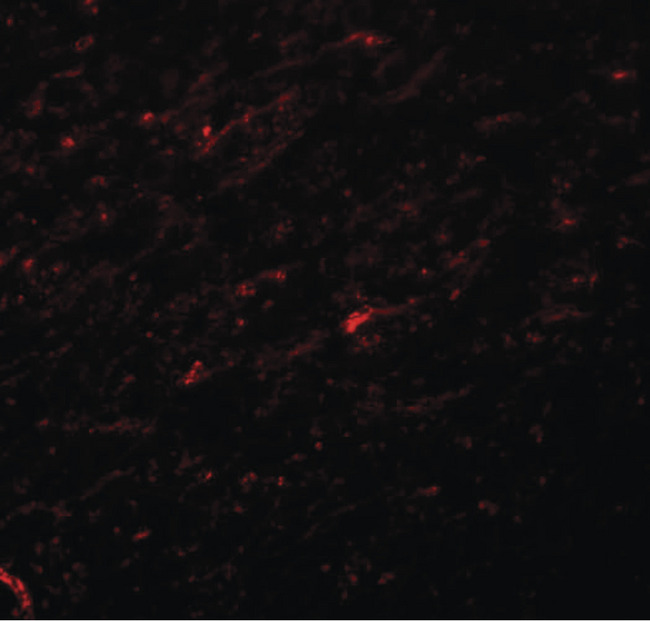 TCF3 / E2A Antibody - Immunofluorescence of TCF3 in rat brain tissue with TCF3 antibody at 20 ug/ml.