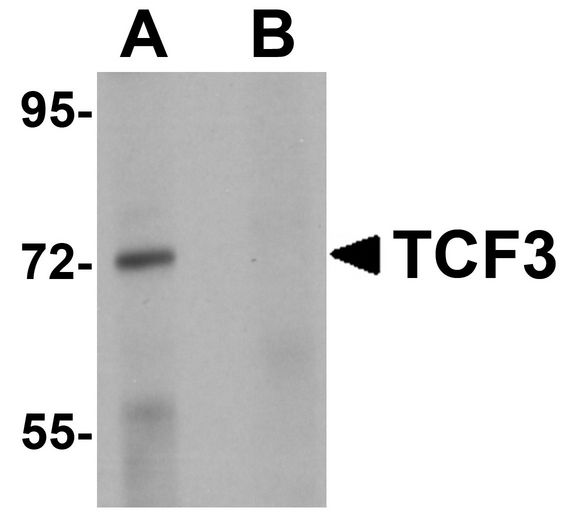 TCF3 / E2A Antibody - Western blot analysis of TCF3 in Human brain tissue lysate with TCF3 antibody at 1 ug/ml in (A) the absence and (B) presence of peptide blocking.