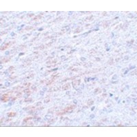 TCF3 / E2A Antibody - Immunohistochemistry of TCF3 in rat liver tissue with TCF3 antibody at 5 µg/mL.