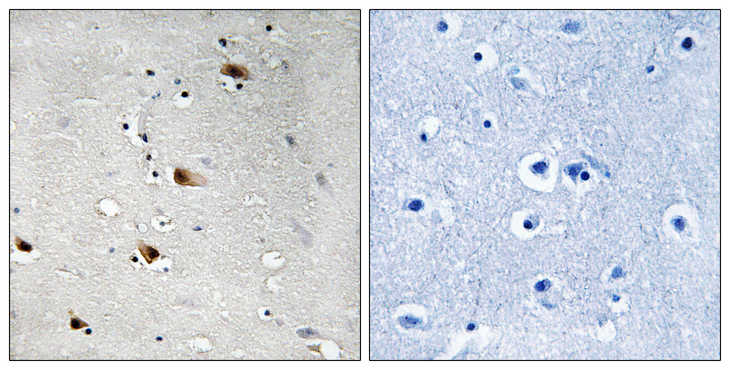 TCF3 / E2A Antibody - Immunohistochemistry analysis of paraffin-embedded human brain, using E2A (Phospho-Thr355) Antibody. The picture on the right is blocked with the phospho peptide.