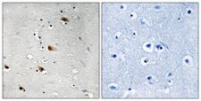 TCF3 / E2A Antibody - Immunohistochemistry analysis of paraffin-embedded human brain, using E2A (Phospho-Thr355) Antibody. The picture on the right is blocked with the phospho peptide.
