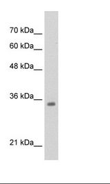 TCF4 Antibody - HepG2 Cell Lysate.  This image was taken for the unconjugated form of this product. Other forms have not been tested.
