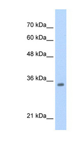 TCF4 Antibody - TCF4 antibody Western blot of HepG2 cell lysate. This image was taken for the unconjugated form of this product. Other forms have not been tested.