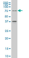 TCF4 Antibody - TCF4 monoclonal antibody (M01), clone 3E10 Western Blot analysis of TCF4 expression in A-549.