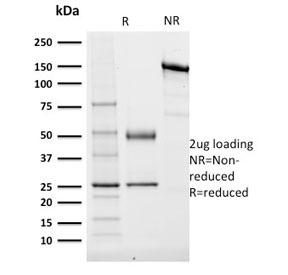 TCF4 Antibody - SDS-PAGE analysis of purified, BSA-free TCF4 antibody (clone TCF4/1705) as confirmation of integrity and purity.