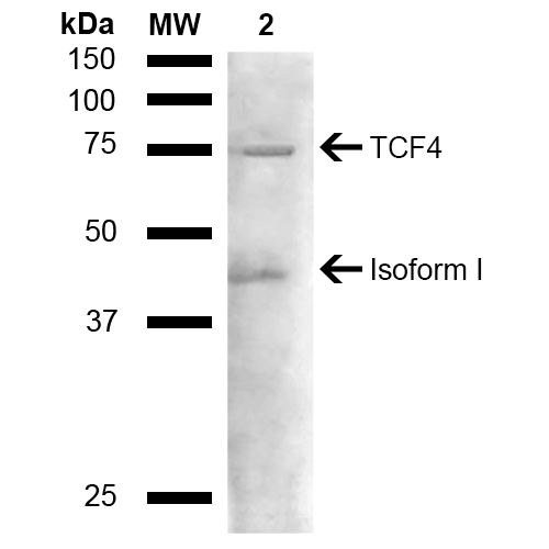 TCF4 Antibody - Western blot analysis of Mouse liver lysate showing detection of ~71.3 kDa TCF4 protein using Rabbit Anti-TCF4 Polyclonal Antibody. Lane 1: Molecular Weight Ladder (MW). Lane 2: Mouse liver lysate. Load: 15 µg. Block: 5% Skim Milk in 1X TBST. Primary Antibody: Rabbit Anti-TCF4 Polyclonal Antibody  at 1:1000 for 2 hours at RT. Secondary Antibody: Goat Anti-Rabbit HRP:IgG at 1:3000 for 1 hour at RT. Color Development: ECL solution for 5 min at RT. Predicted/Observed Size: ~71.3 kDa. Other Band(s): ~45 kDa isoform.