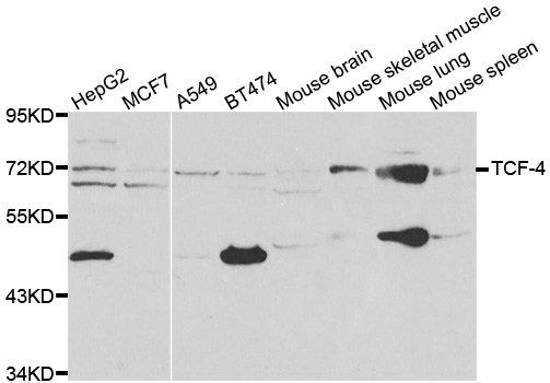 TCF4 Antibody - Western blot analysis of extracts of various cell lines, using TCF4 antibody.