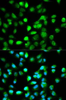 TCF4 Antibody - Immunofluorescence analysis of HeLa cell using TCF4 antibody. Blue: DAPI for nuclear staining.