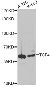 TCF4 Antibody - Western blot analysis of extracts of various cell lines, using TCF4 antibody at 1:1000 dilution. The secondary antibody used was an HRP Goat Anti-Rabbit IgG (H+L) at 1:10000 dilution. Lysates were loaded 25ug per lane and 3% nonfat dry milk in TBST was used for blocking. An ECL Kit was used for detection and the exposure time was 30s.