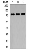 TCF4 Antibody - Western blot analysis of TCF4 expression in HepG2 (A); MCF7 (B); mouse brain (C) whole cell lysates.