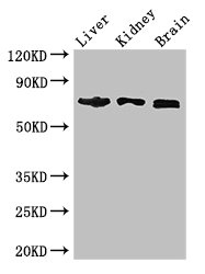 TCF4 Antibody - Western Blot Positive WB detected in:Mouse liver tissue,Mouse kidney tissue,Mouse brain tissue All Lanes: TCF4 antibody at 2.7ug/ml Secondary Goat polyclonal to rabbit IgG at 1/50000 dilution Predicted band size: 72,55,49,66,65,58,68,64,70,69,63 kDa Observed band size: 72 kDa