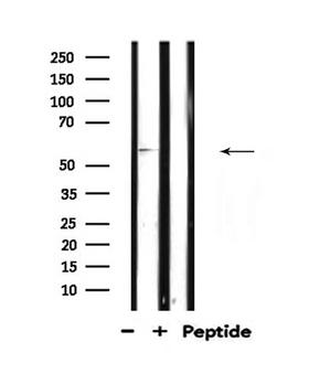 TCF4 Antibody - Western blot analysis of TCF4/12 expression in mouse muscle lysate 