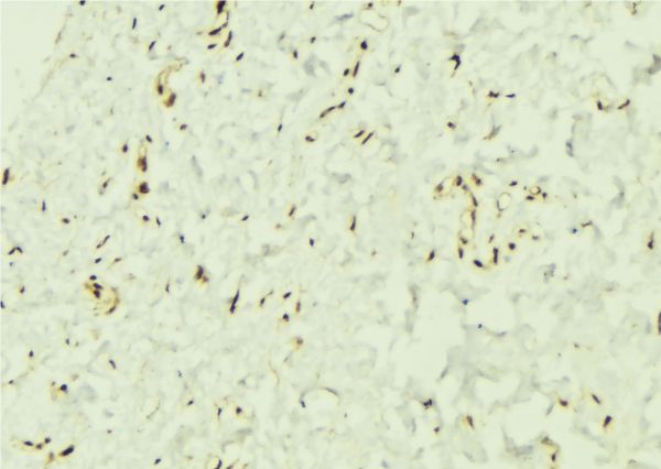 TCF4 Antibody - 1:100 staining mouse muscle tissue by IHC-P. The sample was formaldehyde fixed and a heat mediated antigen retrieval step in citrate buffer was performed. The sample was then blocked and incubated with the antibody for 1.5 hours at 22°C. An HRP conjugated goat anti-rabbit antibody was used as the secondary.