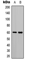 TCF4 + TCF12 Antibody - Western blot analysis of TCF4/12 expression in K562 (A); A549 (B) whole cell lysates.