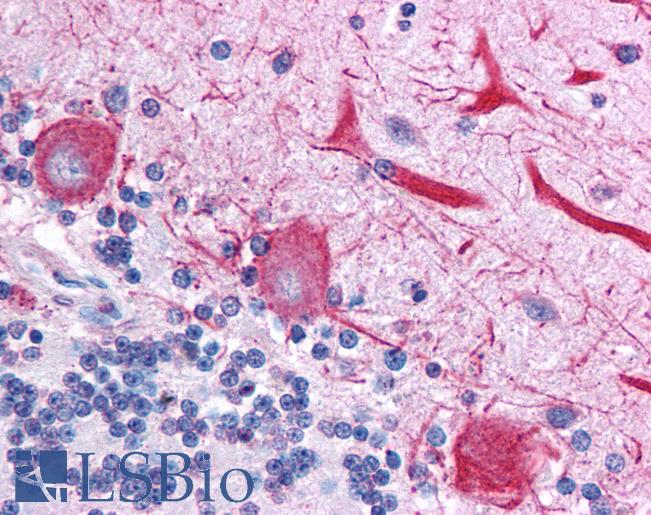 TCF7 Antibody - Brain, cerebellum.  This image was taken for the unconjugated form of this product. Other forms have not been tested.