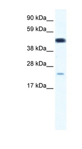 TCF7 Antibody - TCF7 antibody Western blot of Fetal thymus lysate. This image was taken for the unconjugated form of this product. Other forms have not been tested.