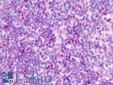 TCF7 Antibody - Anti-TCF7 antibody IHC of human tonsil. Immunohistochemistry of formalin-fixed, paraffin-embedded tissue after heat-induced antigen retrieval. Antibody concentration 5 ug/ml.  This image was taken for the unconjugated form of this product. Other forms have not been tested.