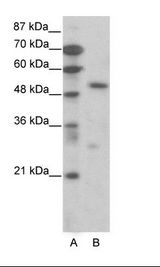 TCF7 Antibody - A: Marker, B: Jurkat Cell Lysate.  This image was taken for the unconjugated form of this product. Other forms have not been tested.