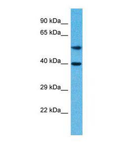 TCF7 Antibody - Western blot of Human Thyroid Tumor. TCF7 antibody dilution 1.0 ug/ml.  This image was taken for the unconjugated form of this product. Other forms have not been tested.