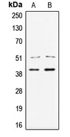 TCF7 Antibody - Western blot analysis of TCF7 expression in Jurkat (A); HCT29 (B) whole cell lysates.