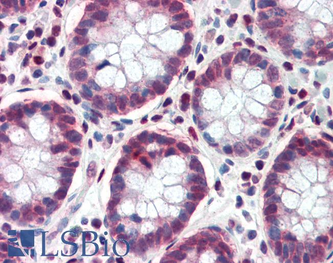 TCF7L1 / TCF-3 Antibody - Anti-TCF7L1 antibody IHC of human colon. Immunohistochemistry of formalin-fixed, paraffin-embedded tissue after heat-induced antigen retrieval. Antibody concentration 5 ug/ml.  This image was taken for the unconjugated form of this product. Other forms have not been tested.