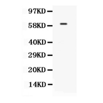 TCF7L1 / TCF-3 Antibody - Western blot analysis of TCF7L1 expression in COLO320 whole cell lysates (lane 1). TCF7L1 at 63 kD was detected using rabbit anti- TCF7L1 Antigen Affinity purified polyclonal antibody at 0.5 ug/mL. The blot was developed using chemiluminescence (ECL) method.