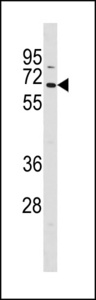 TCF7L1 / TCF-3 Antibody - TCF7L1 Antibody western blot of HepG2 cell line lysates (35 ug/lane). The TCF7L1 antibody detected the TCF7L1 protein (arrow).