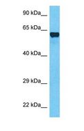 TCF7L1 / TCF-3 Antibody - Western blot of TF7L1 Antibody with human Lung Tumor lysate.  This image was taken for the unconjugated form of this product. Other forms have not been tested.