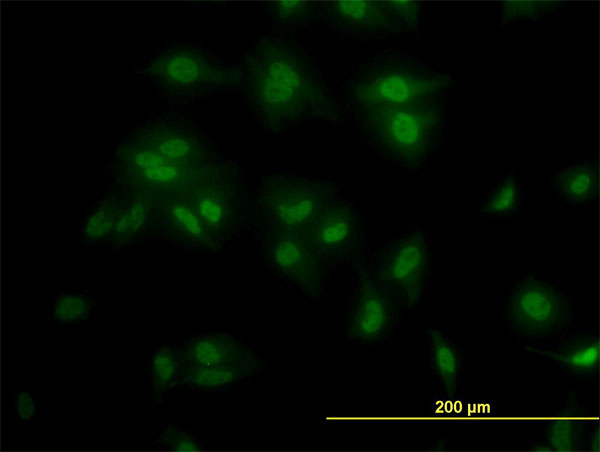 TCF7L2 / TCG4 Antibody - Immunofluorescence of monoclonal antibody to TCF7L2 on HeLa cell (antibody concentration 10 ug/ml).