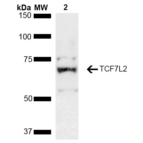 TCF7L2 / TCG4 Antibody - Western blot analysis of Rat kidney lysate showing detection of ~67.9 kDa TCF7L2 protein using Rabbit Anti-TCF7L2 Polyclonal Antibody. Lane 1: Molecular Weight Ladder (MW). Lane 2: Rat kidney lysate. Load: 15 µg. Block: 5% Skim Milk in 1X TBST. Primary Antibody: Rabbit Anti-TCF7L2 Polyclonal Antibody  at 1:1000 for 2 hours at RT. Secondary Antibody: Goat Anti-Rabbit HRP:IgG at 1:3000 for 1 hour at RT. Color Development: ECL solution for 5 min at RT. Predicted/Observed Size: ~67.9 kDa. Other Band(s): ~55 kDa isoform, ~75 kDa due to post translational modification.