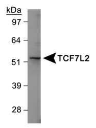 TCF7L2 / TCG4 Antibody - TCF7L2 Antibody - Western Blot on Jurkat cell line.  This image was taken for the unconjugated form of this product. Other forms have not been tested.