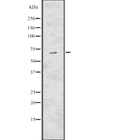 TCF7L2 / TCG4 Antibody - Western blot analysis of TCF7L2 using COLO205 whole lysates.