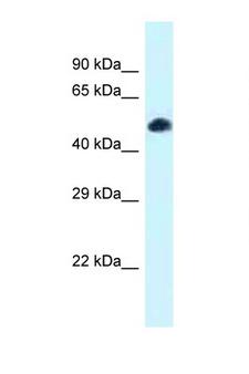 TCF7L2 / TCG4 Antibody - TCF7L2 antibody Western blot of Mouse Spleen lysate. Antibody concentration 1 ug/ml.  This image was taken for the unconjugated form of this product. Other forms have not been tested.