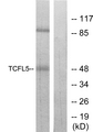 TCFL5 Antibody - Western blot analysis of lysates from RAW264.7 cells, using TCFL5 Antibody. The lane on the right is blocked with the synthesized peptide.