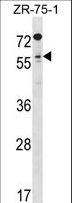 TCFL5 Antibody - TCFL5 Antibody western blot of ZR-75-1 cell line lysates (35 ug/lane). The TCFL5 antibody detected the TCFL5 protein (arrow).