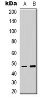 TCFL5 Antibody - Western blot analysis of TCFL5 expression in HepG2 (A); RAW264.7 (B) whole cell lysates.
