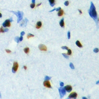 TCFL5 Antibody - Immunohistochemical analysis of TCFL5 staining in human brain formalin fixed paraffin embedded tissue section. The section was pre-treated using heat mediated antigen retrieval with sodium citrate buffer (pH 6.0). The section was then incubated with the antibody at room temperature and detected with HRP and DAB as chromogen. The section was then counterstained with hematoxylin and mounted with DPX.